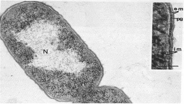 ETUDE MORPHOLOGIQUE DE LA CELLULE BACTERIENNE
